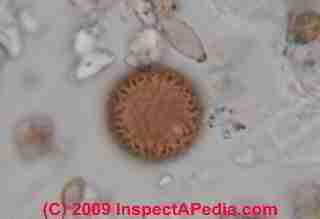 Photographs of spores of Periconia sp. © Daniel Friedman 2001